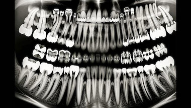 Teeth © Michelle Lou